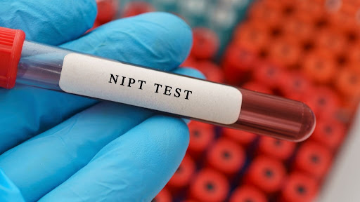 Future of Health: Navigating the Benefits of NIPT Test in Singapore